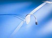 Adjustable system for male urinary incontinence